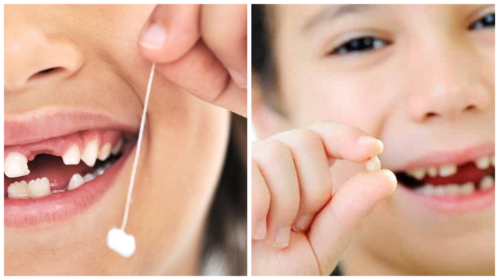Молочные зубы могут вырасти дважды.