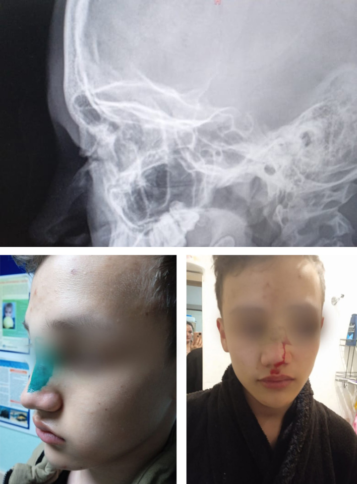 БАНДЫ МИГРАНТОВ ДОБРАЛИСЬ ДО ШКОЛ. ДЕЛО СТАРОЕ – ЖАЛОБЫ НОВЫЕ россия