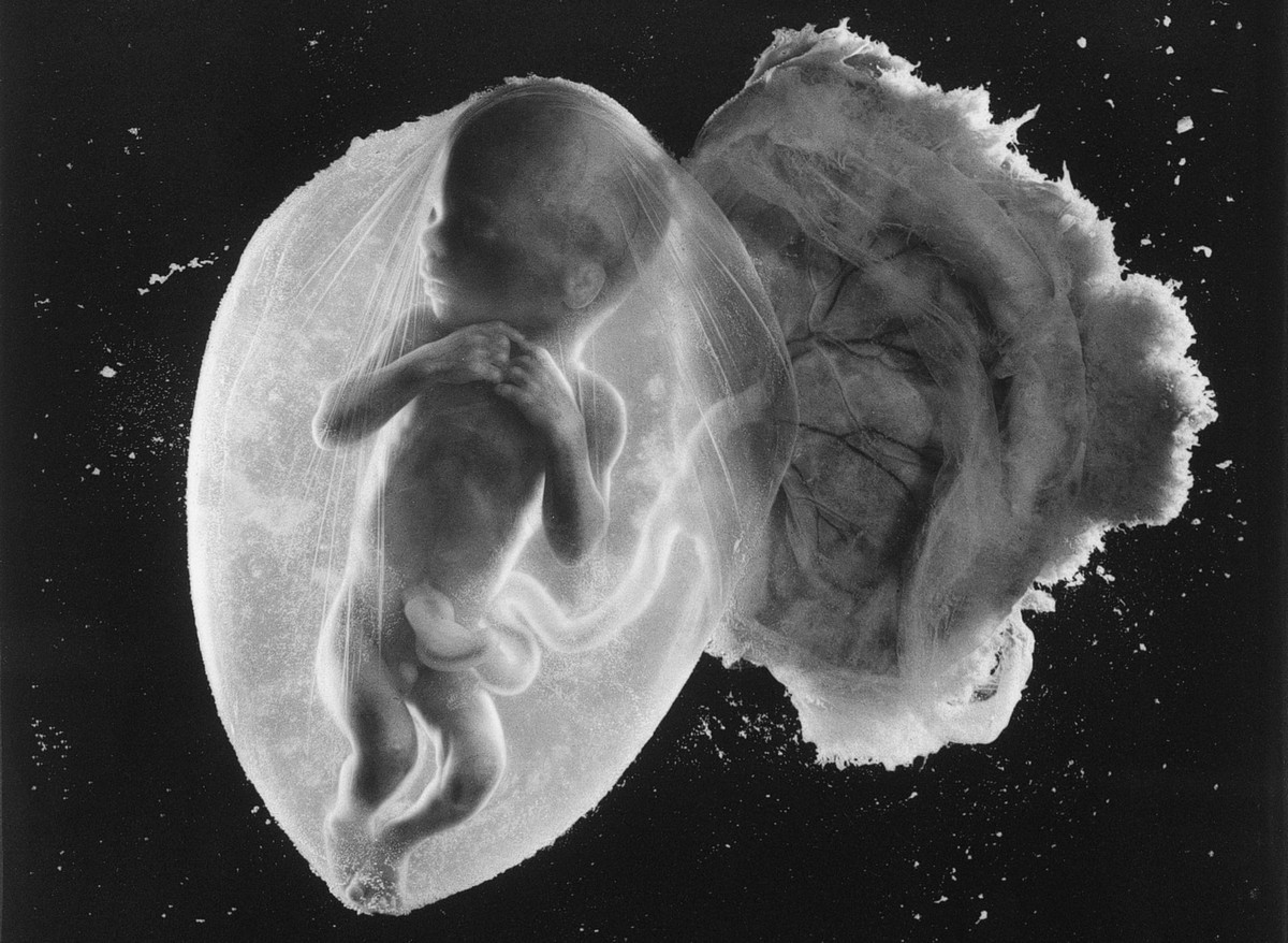 Фото развития ребенка по месяцам в утробе матери