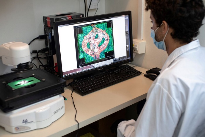 Клетки больных раком используются в напечатанных на 3D-принтере опухолях для тестирования методов лечения