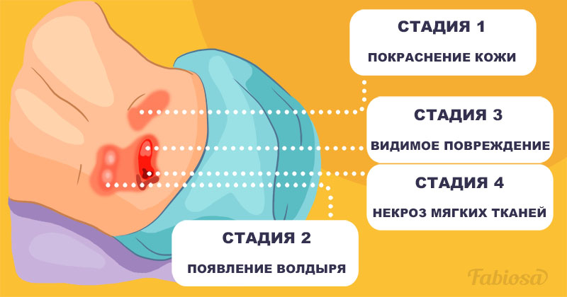 Памятка для родственников пациента