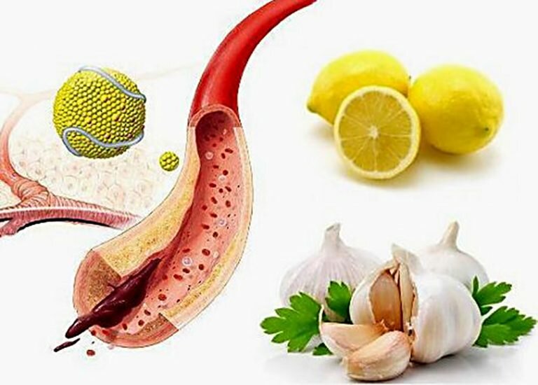 5 продуктов, которые чистят сосуды