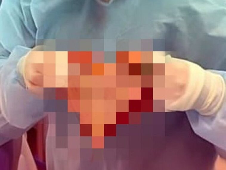 В Новосибирске хирург поздравил приятельницу «валентинкой» из кожи (ФОТО)