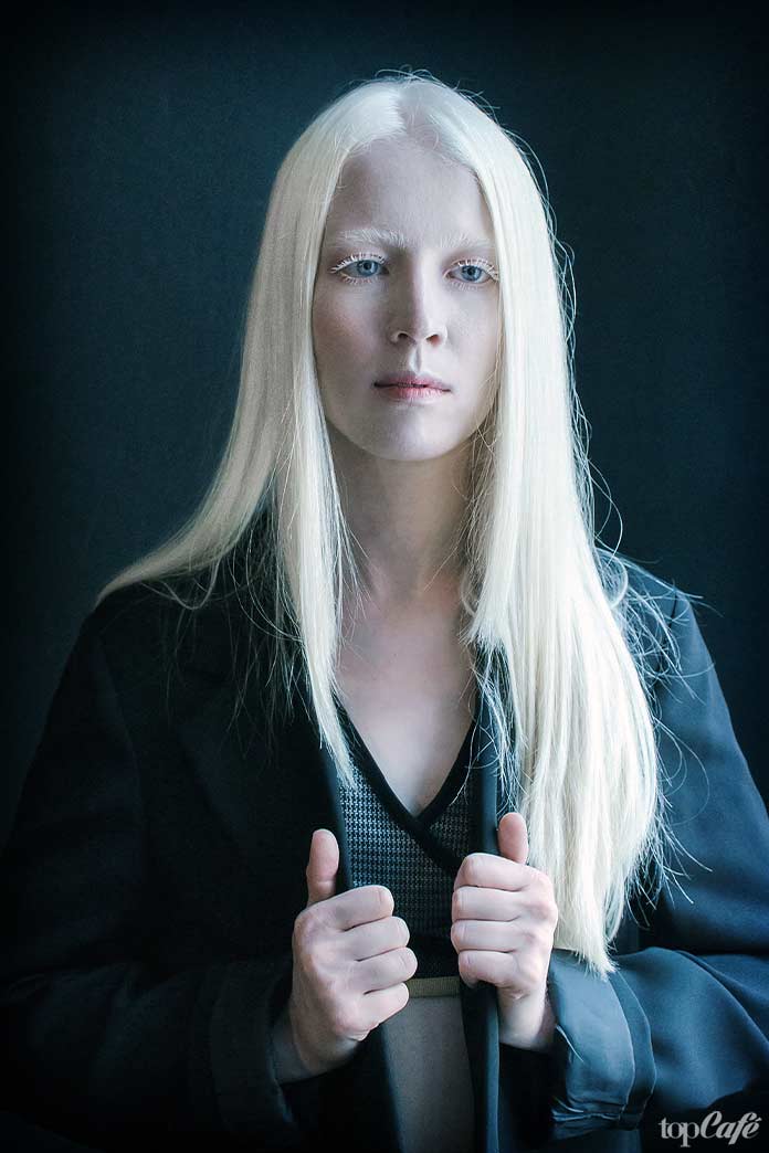 Люди альбиносы: Dessyslava