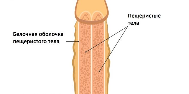 Чем грозит перелом члена и как это лечить болезни,здоровье,мужское здоровье,перелом члена