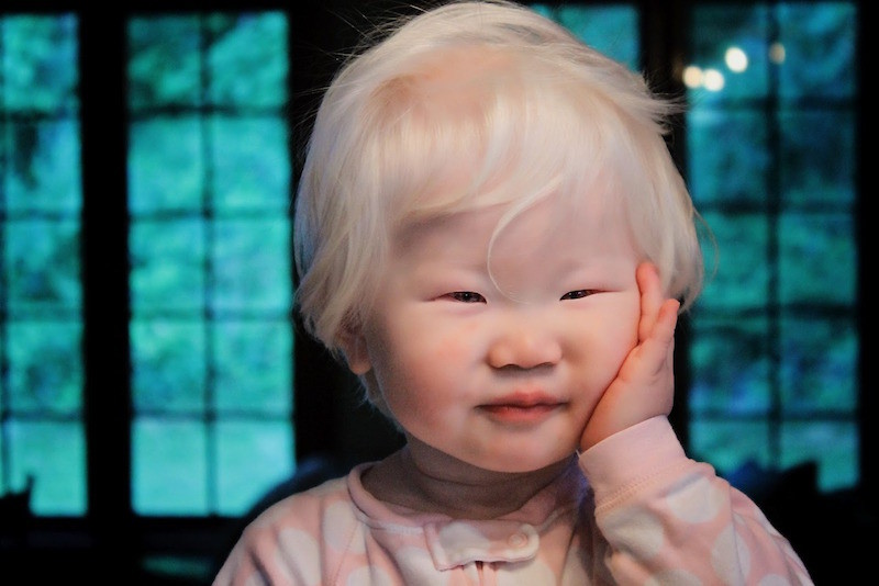 18. Маленький азиат-альбинос. планета земля, удивительные фотографии, человек
