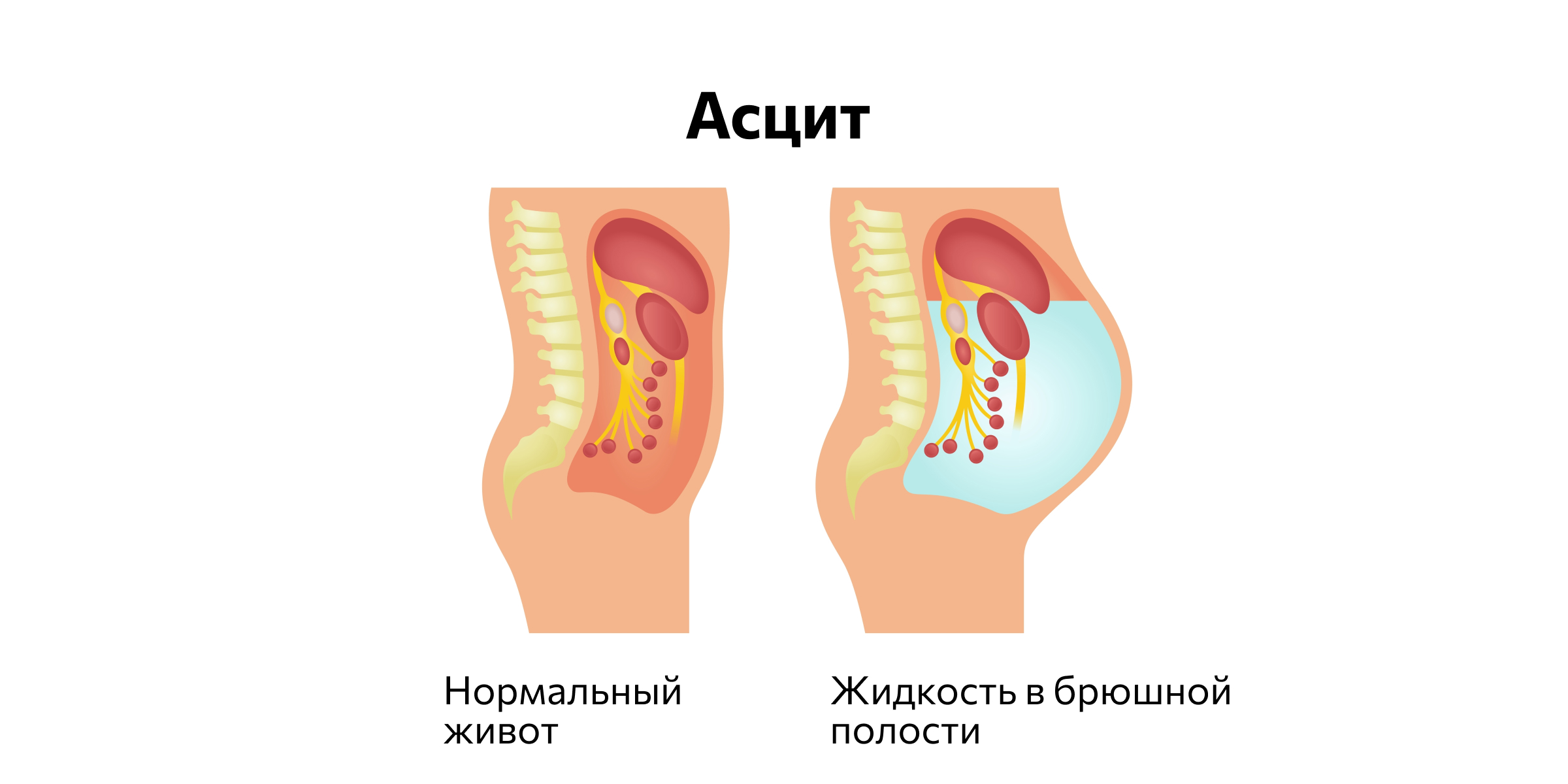 Может ли форма живота рассказать что-то о здоровье Может ли форма живота рассказать что-то о здоровье может, живот, живота, брюшной, органов, время, Иллюстрация, поставить, жировой, полости, уровень, Например, количество, беременности, выглядит, проблемы, ткани, кортизола, форме, когда