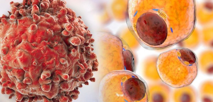 Новый ингибитор LAT1 может ускорить лечение рака