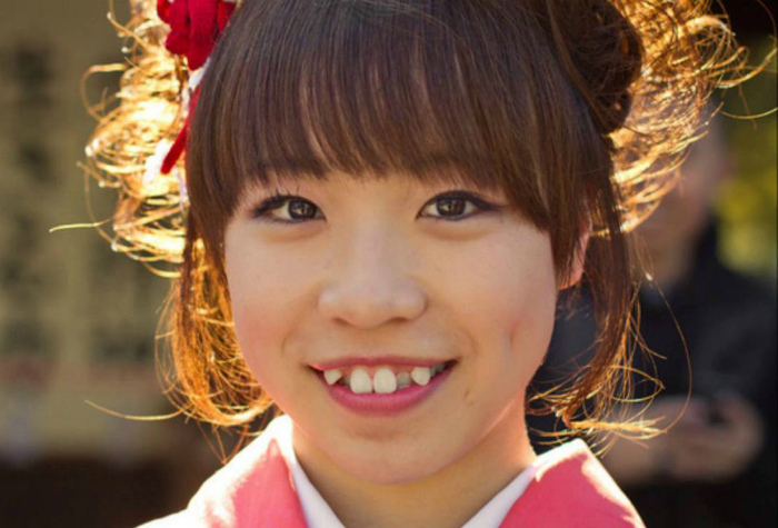 Кривые зубы в Японии.