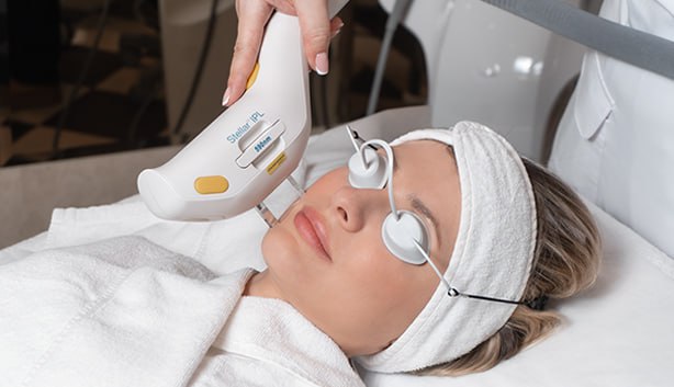 Фотоомоложение на аппарате Stellar M22: как технология помогает вернуть коже ровный тон и упругость