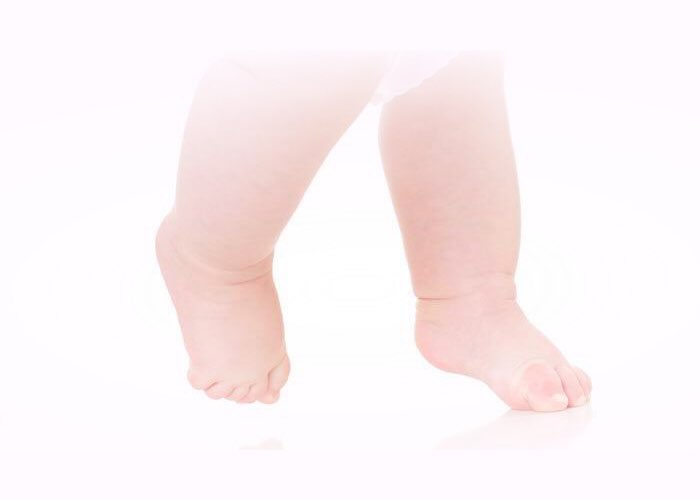 Почему ребенок ходит на носочках (цыпочках): причины, лечение цыпочках, ребенок, ходит, ходить, может, хождение, ребенка, мышцы, носочках, часто, доктор, хождения, обратиться, другие, можно, всего, делать, других, причины, начинает