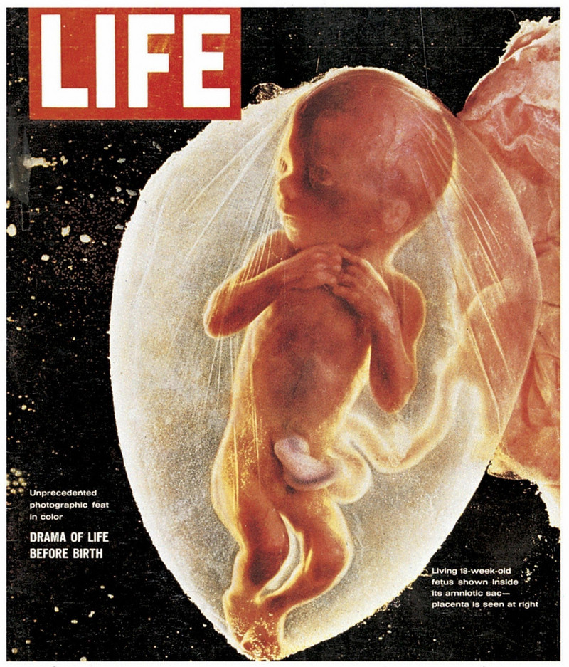 «Эмбрион, 18 недель»: возможно, величайшая фотография 20-го века Нильссон, работы, Фьелльстрем, Нильссона, работал, годах, фотографии, жизни, развития, недель», снимков, движения, глубоко, Photo, Paris, эмбрионы, Швеции, могли, изображения, сделал