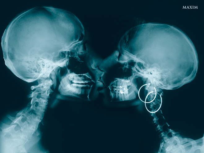 Не дышите! 11 любопытных рентгеновских снимков
