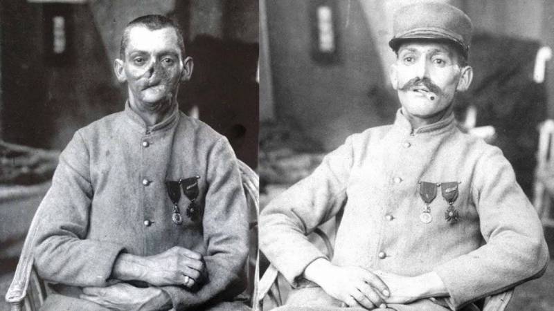 Ужасные раны или многолетнее отравление. Кожно-нарывные ОВ оружие