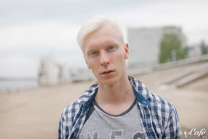 Люди альбиносы в обычной жизни