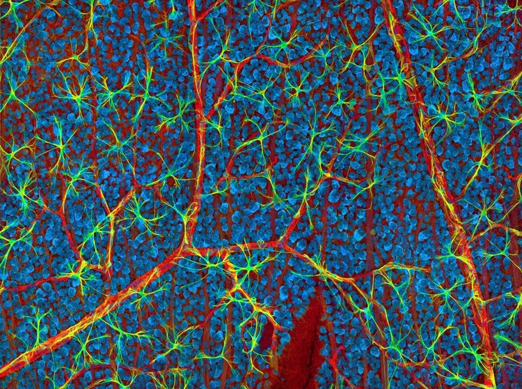 11. Кровеносные сосуды и нервные клетки в сетчатке мыши микроскоп, факты