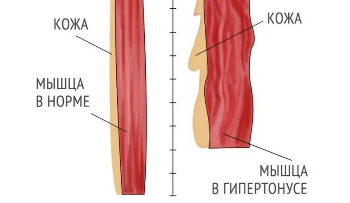 А вы растягиваете жевательные мышцы лица?-3