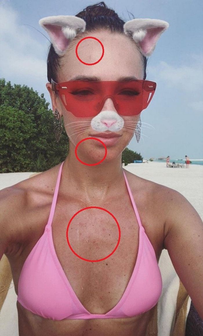 Фанаты в шоке от прыщавого фото Бузовой Фанаты в шоке от прыщавого фото Бузовой