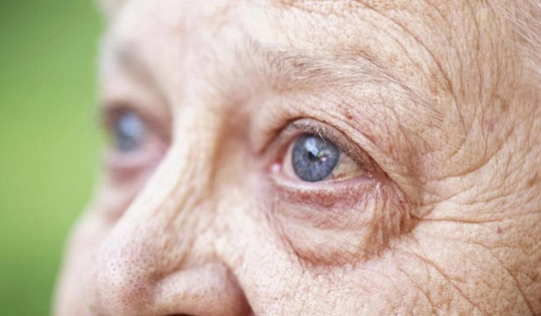 Катаракта у пожилых: как не пропустить симптомы и распознать начальную стадию заболевания здоровье,катаракта,медицина,офтальмология