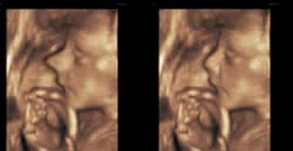 Что теперь сможет сделать с вашим телом пластический хирург Что теперь сможет сделать с вашим телом пластический хирург красота,пластическая хирургия,технологии