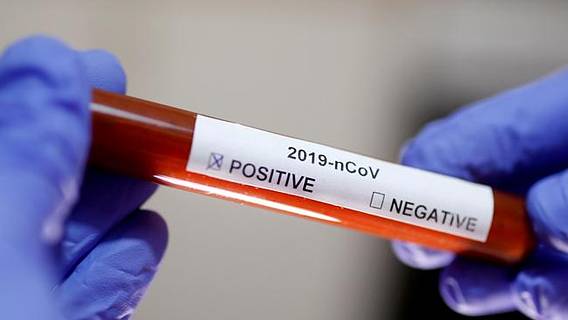 Тысячи сотрудников Amazon в Великобритании получили неверные результаты тестов на Covid-19