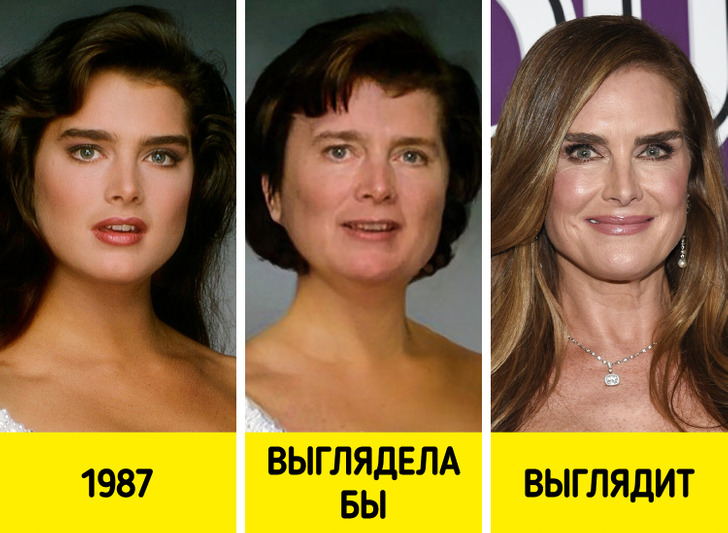 Как могли бы выглядеть знаменитости без современных косметических процедур