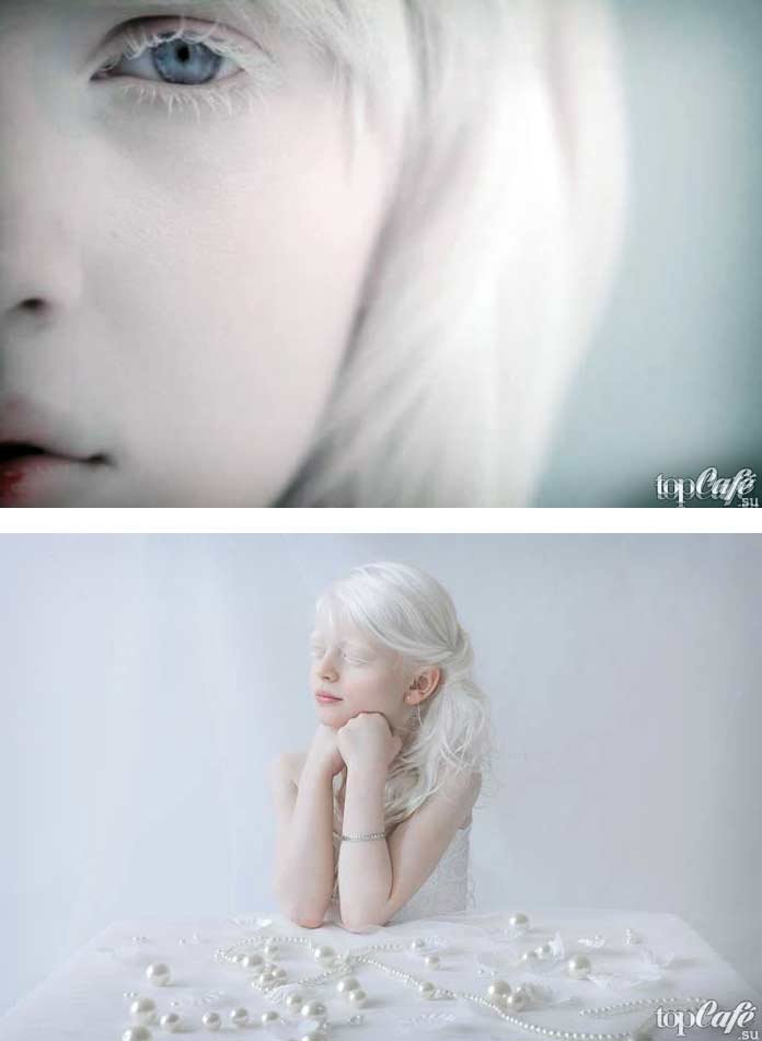 Фото людей альбиносов