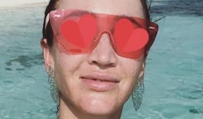 Фанаты в шоке от прыщавого фото Бузовой Фанаты в шоке от прыщавого фото Бузовой