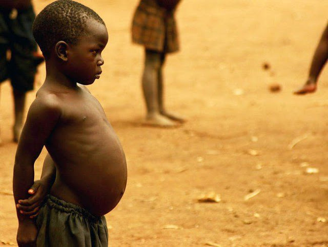 Почему у африканских детей большие животы дети,жизнь,интересное,медицина