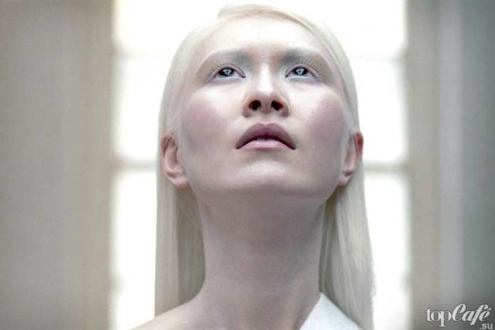 Люди альбиносы: Connie Chiu