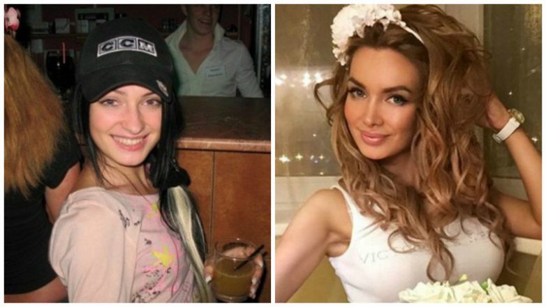 12 российских известных девушей до и после пластики