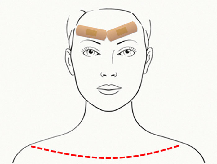 Тейпы для лица от морщин схемы. Пластырь на лоб от морщин. Лейкопластырь от морщин на лице схемы. Пластырь на лице от морщин схемы. Пластырь для лица схемы.
