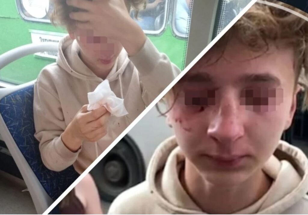В Новосибирске мужчина избил 15-летнего подростка в автобусе из-за его внешности