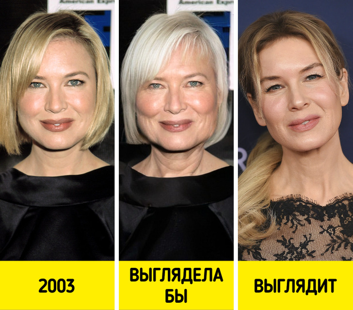 Как могли бы выглядеть знаменитости без современных косметических процедур