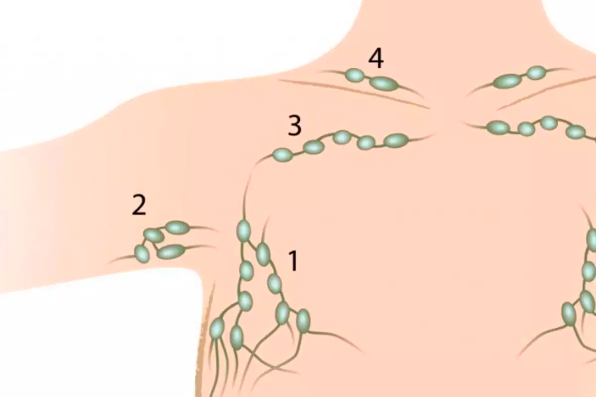 лимфатические узлы на груди у женщин фото 69
