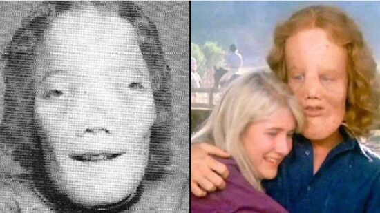 Рой Ли Деннис: как история подростка с редкой болезнью стала сюжетом фильма