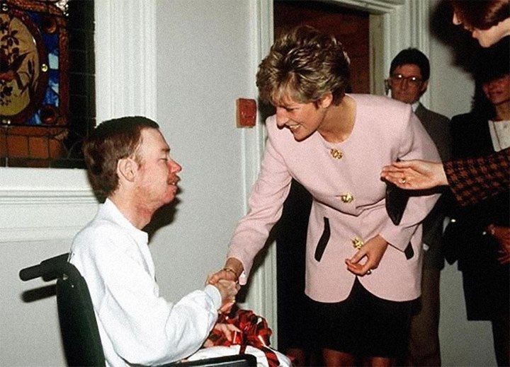 Принцесса Диана пожимает руку больного СПИДом без перчаток. Широкий жест в то время. 1991 год. история, факты, фото
