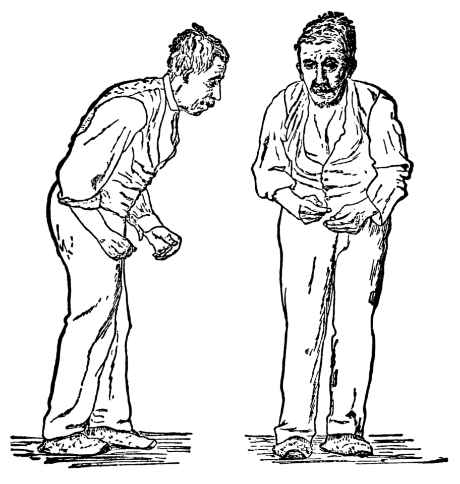 Болезнь паркинсона картинки для презентации