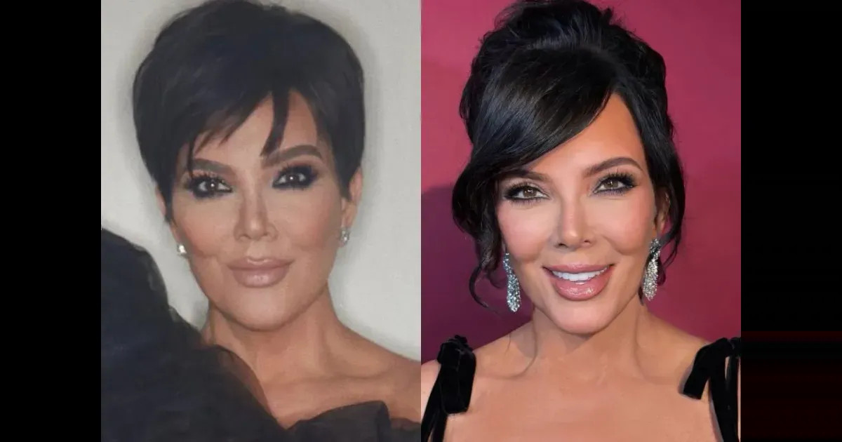 Крис Дженнер, по слухам, недовольна своей подтяжкой лица — эффект оказался недолговечным