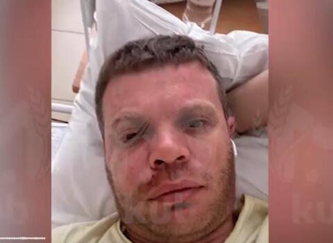 Банда подростков из Краснодара проломила череп мужчине