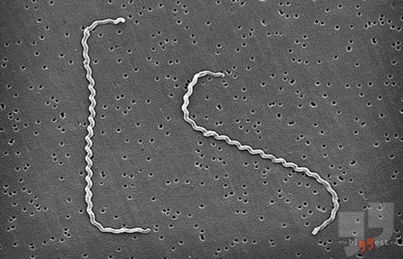 Leptospira interrogans