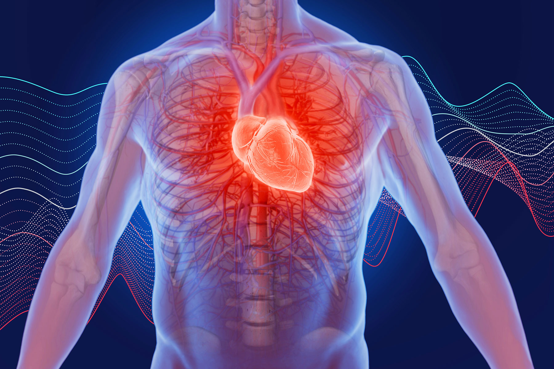 Ишемия мышц. Заболевания сердечно-сосудистой системы. Нарушение сердечно сосудистой системы.