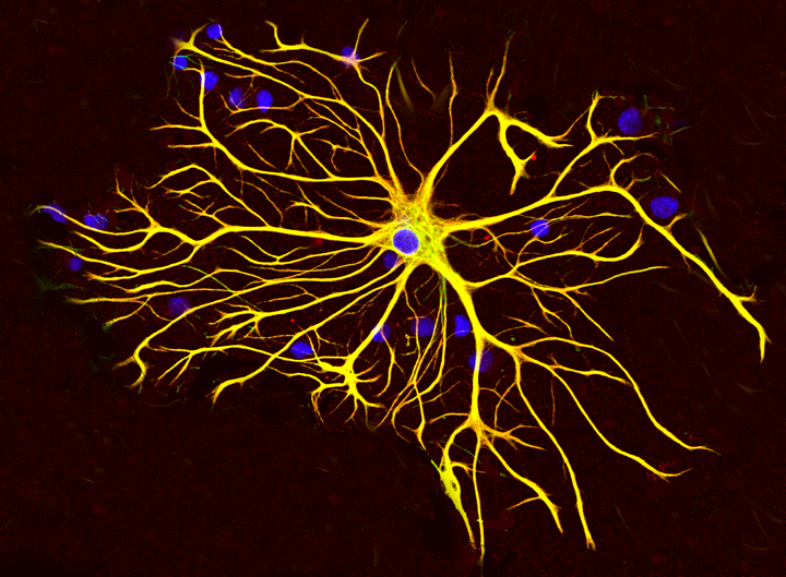 astrocyte