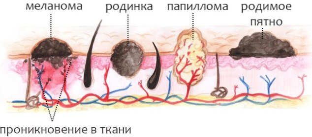 Картинки по запросу папилломы