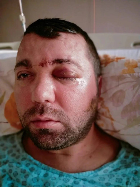 В Турции дантист чуть не убил пациента, вкрутив ему зубной имплант в мозг