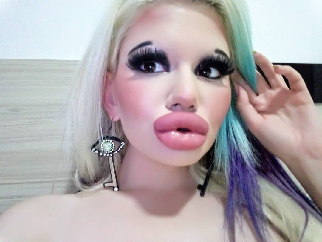 Big lip