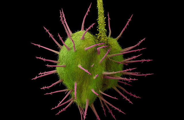 Как выглядит пыльца под микроскопом