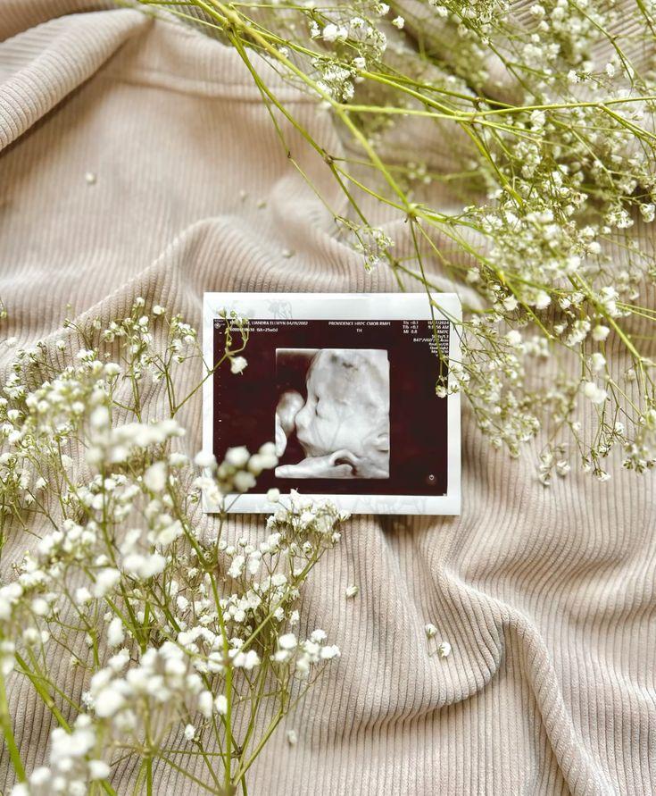 Околоплодные воды: все, что нужно знать беременной об их состоянии околоплодных, ребенка, амниотической, жидкости, амниотическая, жидкость, объем, пузырь, когда, врачи, также, малыша, плодный, можно, ребенок, беременности, может, матки, обычно, околоплодные