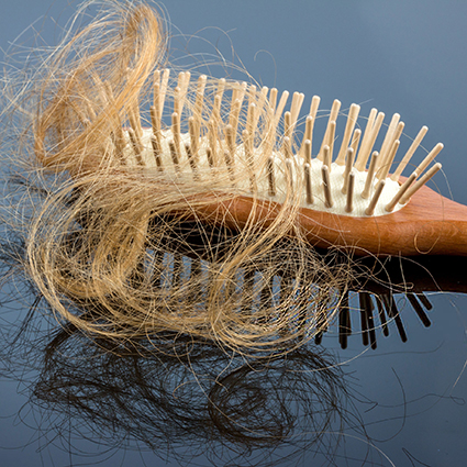 7 простых советов, как предотвратить выпадение волос волос, может, выпадения, стоит, волосы, роста, время, головы, выпадение, также, можно, когда, несколько, стресса, омега3, которые, массаж, будет, просто, способствует