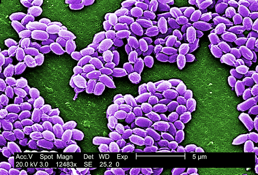 Anthrax_spores_(5940425745).jpg